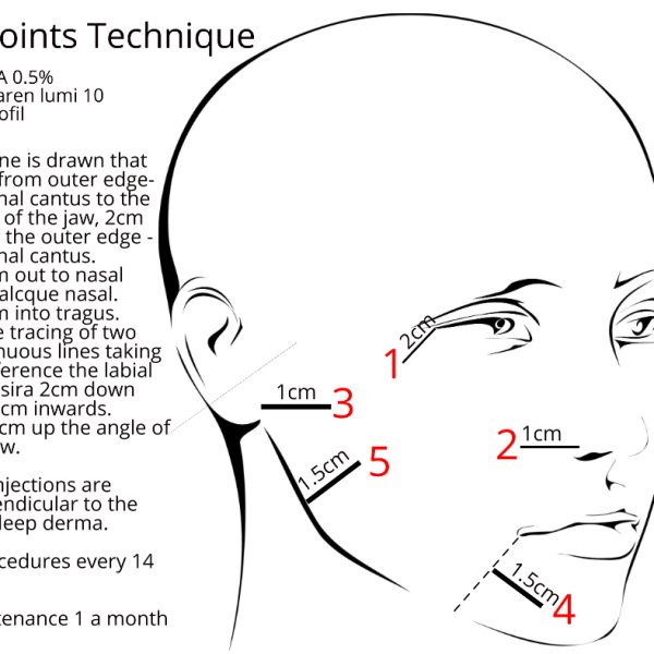 5-points-technique-full-info.jpeg